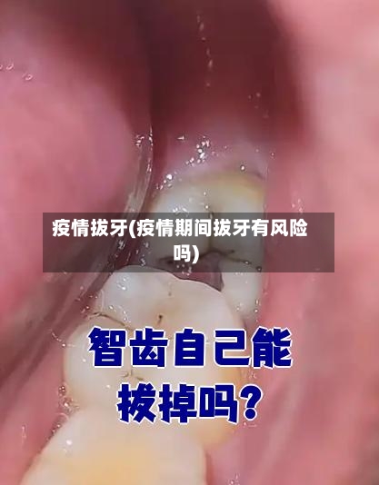 疫情拔牙(疫情期间拔牙有风险吗)-第3张图片