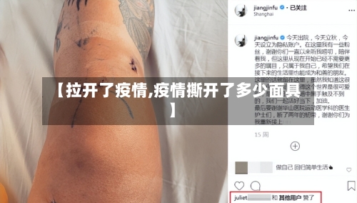 【拉开了疫情,疫情撕开了多少面具】-第2张图片