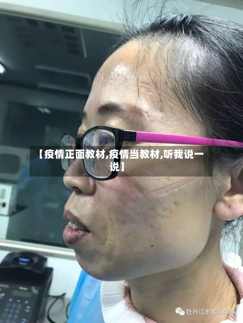 【疫情正面教材,疫情当教材,听我说一说】-第3张图片