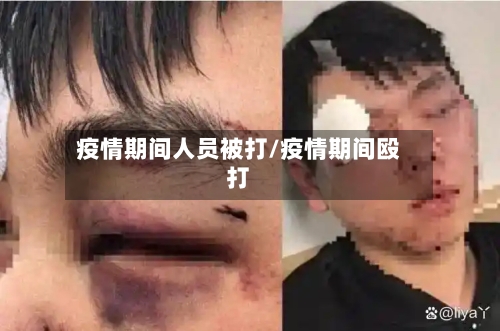 疫情期间人员被打/疫情期间殴打-第3张图片