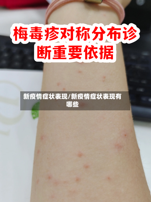 新疫情症状表现/新疫情症状表现有哪些-第3张图片