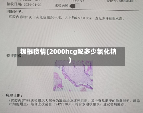 锡根疫情(2000hcg配多少氯化钠)-第2张图片