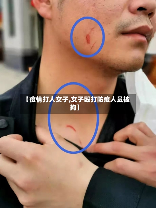 【疫情打人女子,女子殴打防疫人员被拘】-第2张图片