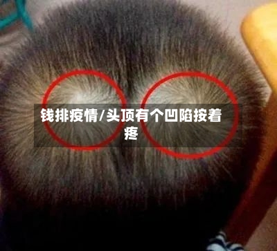 钱排疫情/头顶有个凹陷按着疼