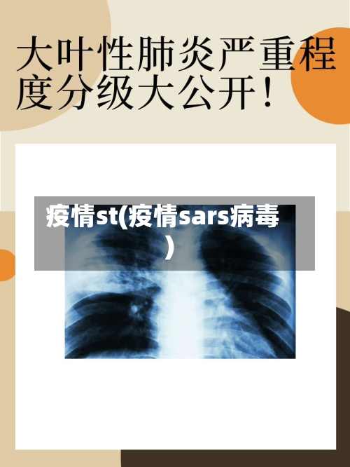 疫情st(疫情sars病毒)