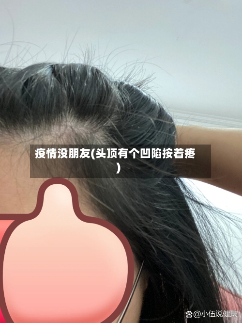 疫情没朋友(头顶有个凹陷按着疼)-第2张图片