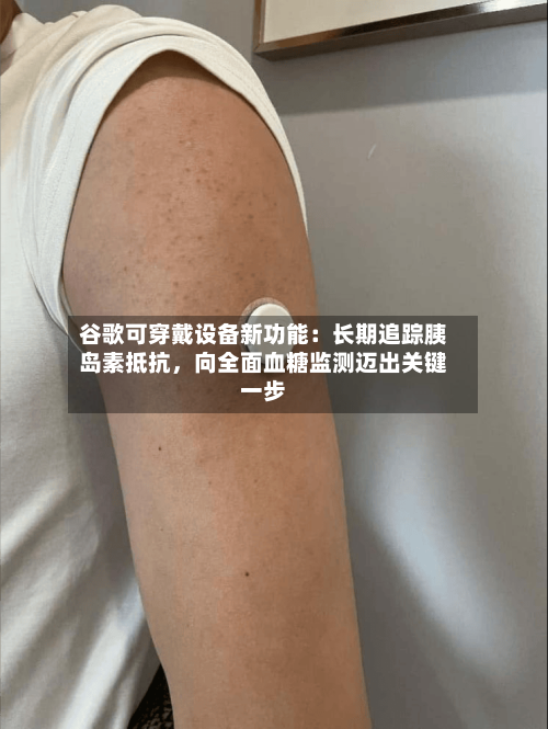 谷歌可穿戴设备新功能：长期追踪胰岛素抵抗，向全面血糖监测迈出关键一步