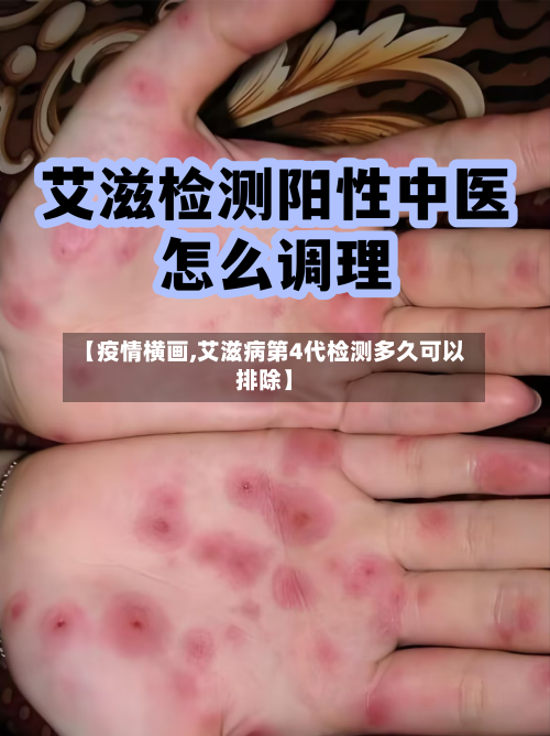 【疫情横画,艾滋病第4代检测多久可以排除】-第2张图片