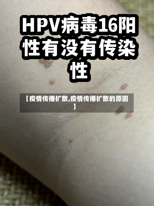 【疫情传播扩散,疫情传播扩散的原因】