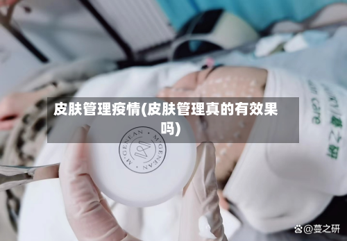 皮肤管理疫情(皮肤管理真的有效果吗)