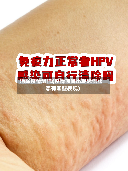 消除疫情恐慌(疫情期间出现恐慌状态有哪些表现)-第1张图片