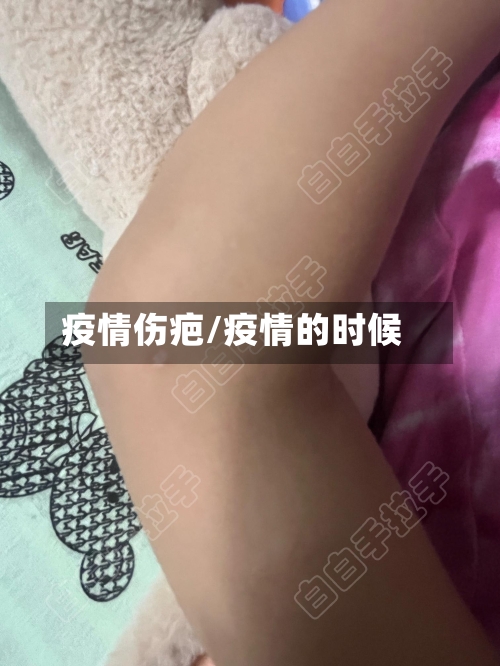 疫情伤疤/疫情的时候